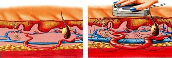 se suas pernas ficarem dormentes